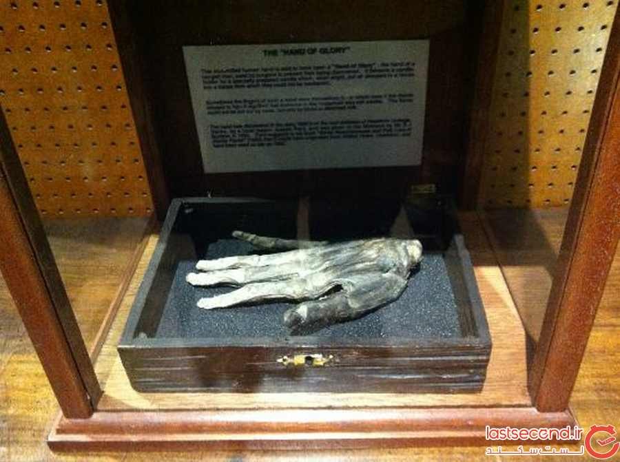 دست بریده  ای که در یک موزه مهم نگهداری می شود