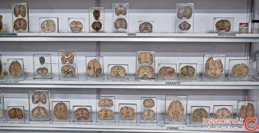 اجزای بدن انسان در موزه مغز هند
