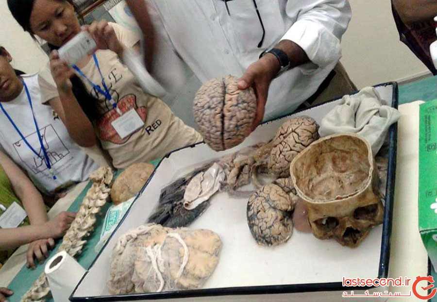 موزه مغز هند
