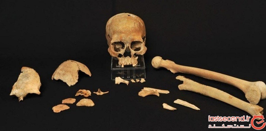 باقدمت ترین دی‌ ان‌ اِی انسانی در یک آدامس 10000 ساله کشف شد
