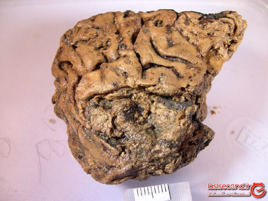 دانشمندان بقایای انسانی 2600 ساله را با مغزی تقریبا سالم کشف کردند!