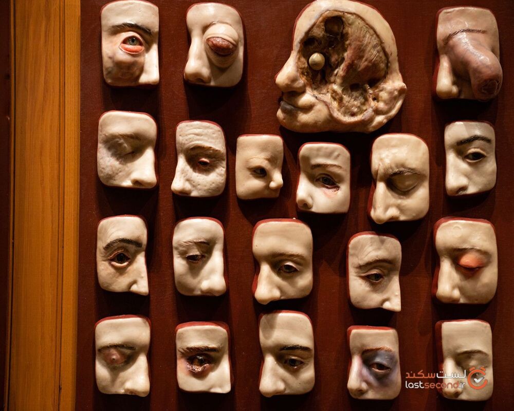 دیوار چشم موزه ماتر