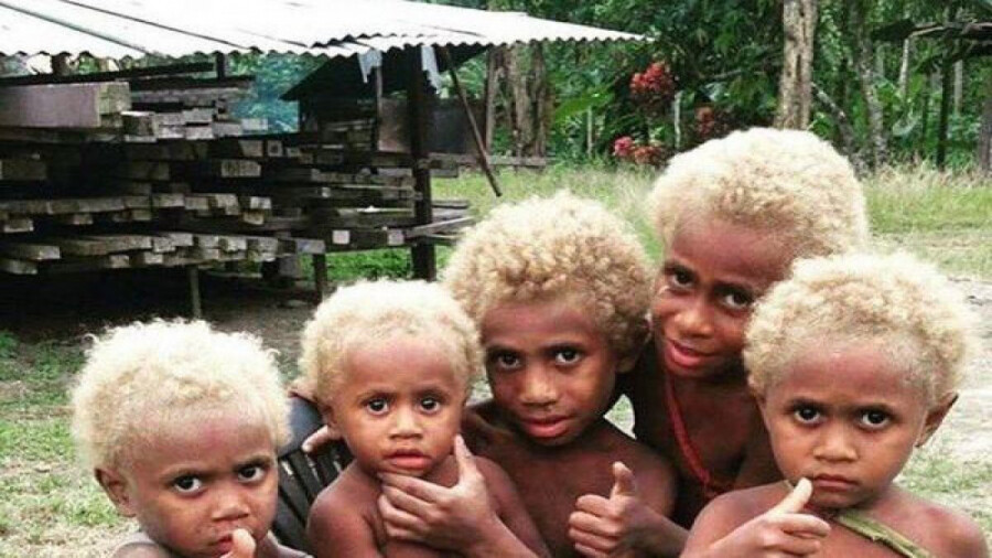 چرا سیاهپوستان این منطقه موهای بور دارند؟